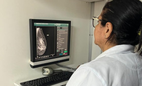 Outubro Rosa: confira como fazer mamografia gratuita pelo SUS no Piauí