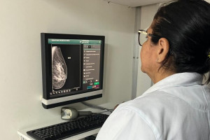 Outubro Rosa: confira como fazer mamografia gratuita pelo SUS no Piauí